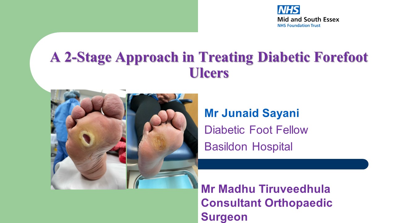 A 2-stage Approach In Managing Diabetic Forefoot Ulcers