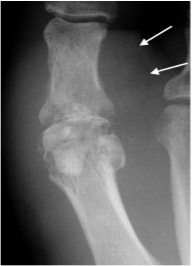 BOFAS > Hyperbook > Radiology > 8. Joint and Soft Tissue Pathology